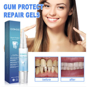 Teeth Repair Gel